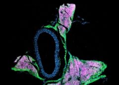 Il grasso beige è amico dei vasi sanguigni, abbassa la pressione