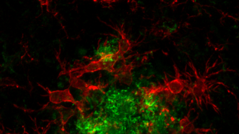 Una molecola smart contro l'Alzheimer, aiuta le difese naturali